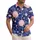 duiyfppz/products/6a0c1d880558985a6f3939d9/gallery/OvjrhQanXe