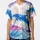 duiyfppz/products/6a3e6c76f71d3f8a134a1072/gallery/qjJTtTcShY