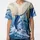 duiyfppz/products/6a3fe67a579e66a478b3aada/gallery/3LgzIH-xpJ
